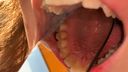 【蛀牙和谷的注意事項】和之子天花板！ （*注）當我用鏡子檢查大女人（喉嚨雞巴）的嘴巴內部時，它充滿了褶皺和空腔w Anri [Y-079]