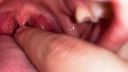 你不想看到貝平的喉嚨嗎？ “喉嚨觀察和強烈的摸索和舌苔聞聞”任[Y-108]