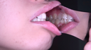 【Teeth】Popular actress Ameri Chan's teeth observation & electric masturbation with the mouth opening attached!!