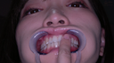 【Teeth】Popular actress Ameri Chan's teeth observation & electric masturbation with the mouth opening attached!!