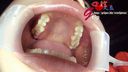 Amateur OL Sayaka lens licking tongue & beautiful oral aperture appreciation without cavities
