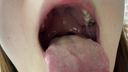 The tongue moss of a serious student is yellow AYANA KITR00291