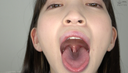 【Teeth / Mouth】Very popular actress Fuyuai Kotone Chan's mouse opener and observe teeth, mouth, throat, tongue!