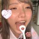 【個人撮影】激カワ美少女音大生の舌苔採取　ゆい【Y-173】