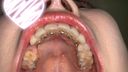 【Personal Shooting】Orthodontic Tooth Observation & Pencil Gnawing of Geki Kawa Beautiful Girl Music College Student Yui [Y-174]