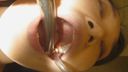 【Oral treatment】 Karte01 - Mizuki #3