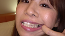 【Teeth / Mouth】Popular actress True White Wakana Chan's extremely rare teeth, mouth, throat observation!