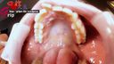 Amateur virgin Hina wisdom teeth & mouth opening appreciation of oral cavity with missing back of front teeth