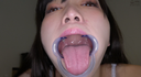 【Teeth and mouth】Popular actress Hoshi Ameri Chan's teeth & tongue bello mouth observation work