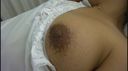 While the hospitalized patient was sleeping, I secretly flipped over the chest and observed the nipples.　03