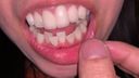 3rd Tooth Princess [FBOM-00003]