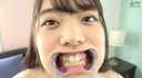 【Mouth】Popular actress Mai Mizuto Mai Chan's extremely rare teeth and mouth observation!