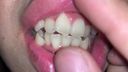 2nd Tooth Princess [FBOM-00002]