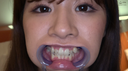 【Teeth / Mouth】Popular actress True White Wakana Chan's extremely rare teeth, mouth, throat observation!