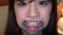 【Teeth / Mouth】Popular actress True White Wakana Chan's extremely rare teeth, mouth, throat observation!