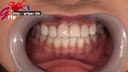 긴 혀의 사키바 유이카의 은색 치아 1개로 구강을 초접업