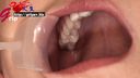 긴 혀의 사키바 유이카의 은색 치아 1개로 구강을 초접업