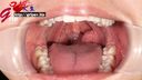 Beautiful gal Haruka Yuzuki's beautiful teeth saliva inside the mouth aperture appreciation