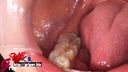 Long tongue beautiful form RQ Hayakawa Mizuki 1 beautiful tooth line Mouth opening appreciation inside the oral cavity