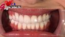 긴 혀 아름다움 형태 RQ 하야카와 미즈키 1 아름다운 치아 라인 구강 내 입 개방 감상