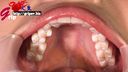 Long tongue beautiful form RQ Hayakawa Mizuki 1 beautiful tooth line Mouth opening appreciation inside the oral cavity