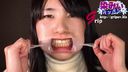 Close-up appreciation of pure shaved girl Kasumi's petite yellowed teeth and oral cavity with a mouth aperture