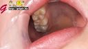 Close-up viewing of the beautiful oral cavity without cavities of de S Kasumi Adachi with a mouth opening