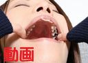 Sachi-chan的牙齒有更多的銀牙，不是嗎？！　