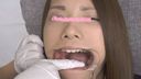 Sachi-chan's teeth have more silver teeth, don't they?!　