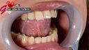 元歯科衛生士りんの銀歯を白に変えた口腔＆51mm美麗舌接写鑑賞