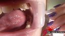 딕 러버 OL 카나의 실버 투스 3 구강 조리개 및 43mm 혀 클로즈업