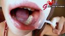 No silver teeth or cavities of Misuzu, a beautiful married woman with glasses! Oral & beautiful tongue aperture close-up