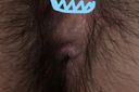 【Post】Ass hair! Take a close look at the and anus of a super hairy beauty!