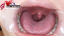 Nasty nose OL Kokone's mouth aperture oral close-up appreciation found wisdom teeth