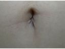 Navel of 100 amateurs 6