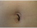 Navel of 100 amateurs 6