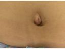 Navel of 100 amateurs 6