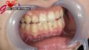 Surprisingly domineering female college student thigh caries treated oral cavity mouth aperture close-up appreciation
