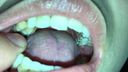 Orthodontic Teeth Mania Feeling Tears! Longing for tearful beautiful dentition Yui(1) KITR00264
