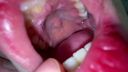 [This is already a vagina] Oral cavity that seems to eat Ji ● Port more than food Rear (2) KITR00274