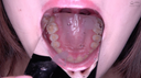 【Teeth / Mouth】Geki Kawa Actress Abe Mikako Chan's teeth and throat observation!