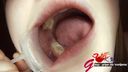 Surprisingly domineering female college student thigh caries treated oral cavity mouth aperture close-up appreciation
