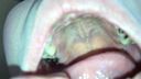 Observe the oral cavity even deeper Yuka(5) KITR00248