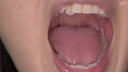 【Teeth and mouth fetish】Popular actress Annan Momoi's extremely rare silver teeth, throat dick, chewing video!!