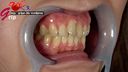 Amateur virgin Hina wisdom teeth & mouth opening appreciation of oral cavity with missing back of front teeth