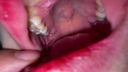 [This is already a vagina] Oral cavity that seems to eat Ji ● Port more than food Rear (2) KITR00274