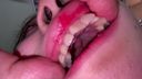 [This is already a vagina] Oral cavity that seems to eat Ji ● Port more than food Rear (2) KITR00274