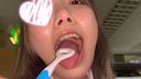 【個人撮影】激カワ美少女音大生の舌苔採取　ゆい【Y-173】
