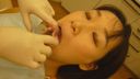 【Oral treatment】 Karte01 - Mizuki #2