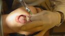 【Oral treatment】 Karte01 - Mizuki #2